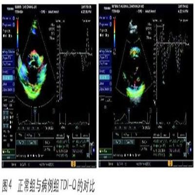 左心室舒张功能减低怎么办