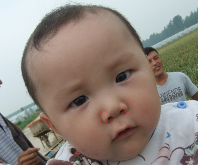小儿感冒如何护理