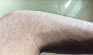 汗毛重怎么办 几种方式不妨试试