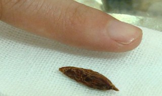 枣核怎么能种出枣树 枣核如何播种